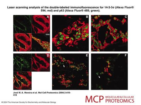 Laser scanning analysis of the double-labeled immunofluorescence for 14-3-3σ (Alexa Fluor® 594; red) and p63 (Alexa Fluor® 488; green). Laser scanning.