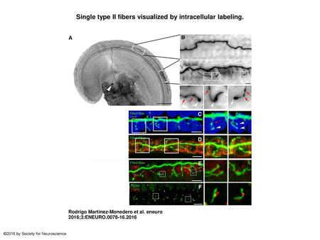 Single type II fibers visualized by intracellular labeling.