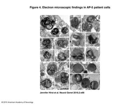 Figure 4. Electron microscopic findings in AP-5 patient cells