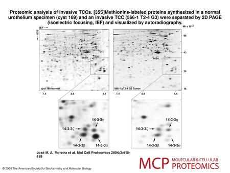 Proteomic analysis of invasive TCCs