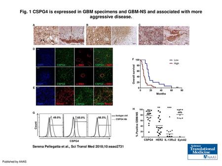 Fig. 1 CSPG4 is expressed in GBM specimens and GBM-NS and associated with more aggressive disease. CSPG4 is expressed in GBM specimens and GBM-NS and associated.