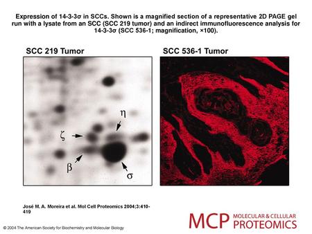 Expression of 14-3-3σ in SCCs Expression of 14-3-3σ in SCCs. Shown is a magnified section of a representative 2D PAGE gel run with a lysate from an SCC.