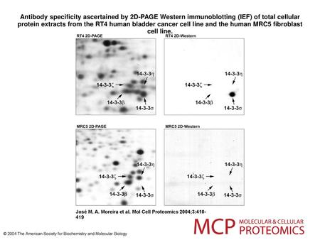 Antibody specificity ascertained by 2D-PAGE Western immunoblotting (IEF) of total cellular protein extracts from the RT4 human bladder cancer cell line.