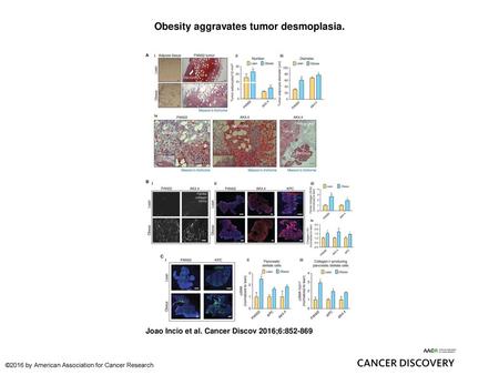 Obesity aggravates tumor desmoplasia.