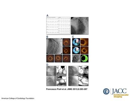 Francesco Prati et al. JIMG 2013;6: