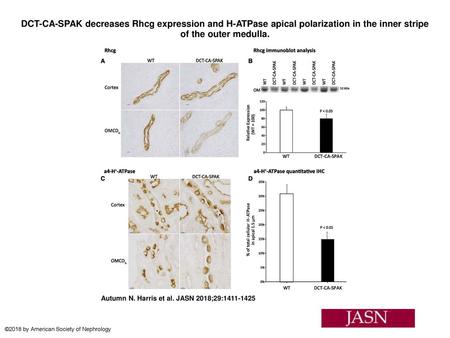 DCT-CA-SPAK decreases Rhcg expression and H-ATPase apical polarization in the inner stripe of the outer medulla. DCT-CA-SPAK decreases Rhcg expression.