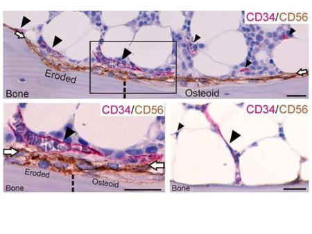 JBMR 2012;doi:[ /jbmr.1760] (Fig. 3A)