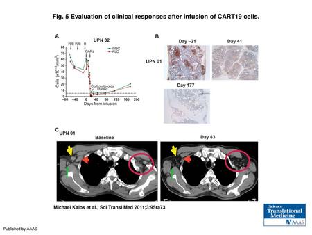 Evaluation of clinical responses after infusion of CART19 cells