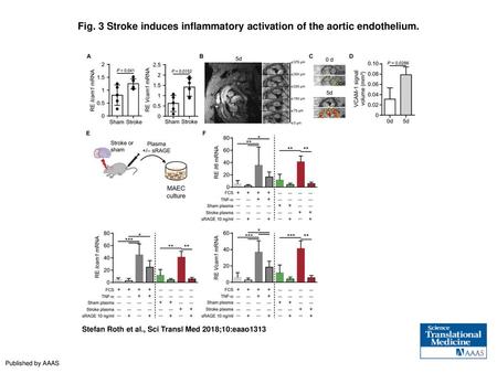 Stroke induces inflammatory activation of the aortic endothelium