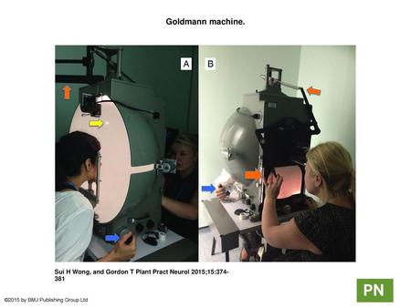 Goldmann machine. Goldmann machine. The patient's eye is positioned at the centre of a white hemispheric bowl, with the examiner looking through an eyepiece.