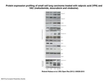 Protein expression profiling of small cell lung carcinoma treated with valproic acid (VPA) and VAC (mafosfamide, doxorubicin and vindesine). Protein expression.