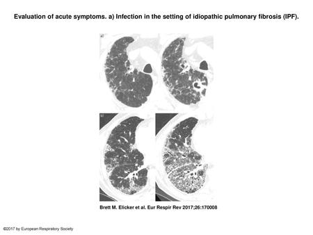 Evaluation of acute symptoms