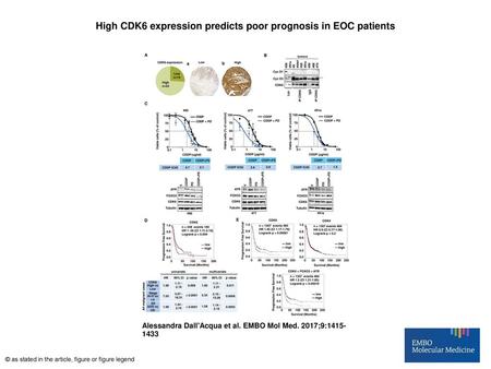 High CDK6 expression predicts poor prognosis in EOC patients