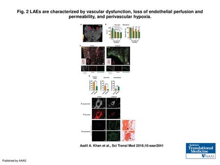 Fig. 2 LAEs are characterized by vascular dysfunction, loss of endothelial perfusion and permeability, and perivascular hypoxia. LAEs are characterized.