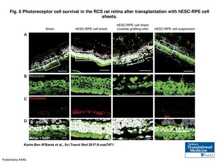 Fig. 6 Photoreceptor cell survival in the RCS rat retina after transplantation with hESC-RPE cell sheets. Photoreceptor cell survival in the RCS rat retina.