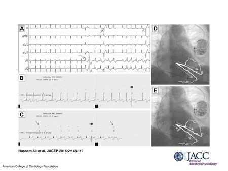 Hussam Ali et al. JACEP 2016;2: