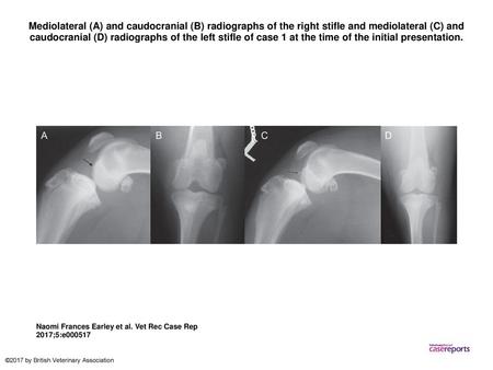 Mediolateral (A) and caudocranial (B) radiographs of the right stifle and mediolateral (C) and caudocranial (D) radiographs of the left stifle of case.