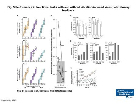 Fig. 3 Performance in functional tasks with and without vibration-induced kinesthetic illusory feedback. Performance in functional tasks with and without.