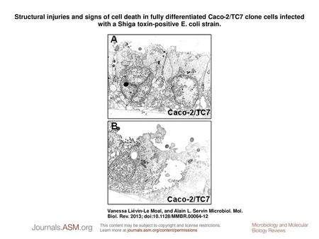 Structural injuries and signs of cell death in fully differentiated Caco-2/TC7 clone cells infected with a Shiga toxin-positive E. coli strain. Structural.