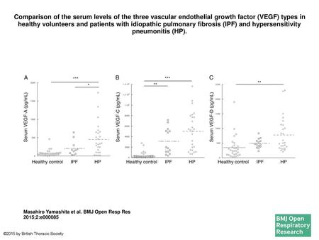 Comparison of the serum levels of the three vascular endothelial growth factor (VEGF) types in healthy volunteers and patients with idiopathic pulmonary.