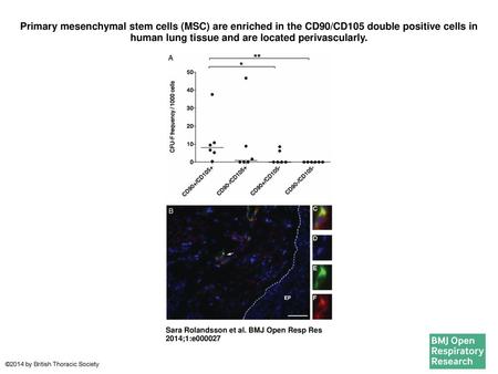 Primary mesenchymal stem cells (MSC) are enriched in the CD90/CD105 double positive cells in human lung tissue and are located perivascularly. Primary.