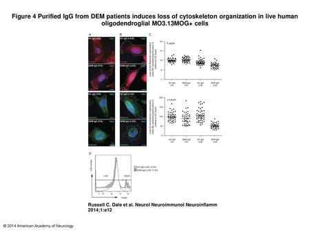 Figure 4 Purified IgG from DEM patients induces loss of cytoskeleton organization in live human oligodendroglial MO3.13MOG+ cells Purified IgG from DEM.