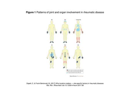 Figure 1 Patterns of joint and organ involvement in rheumatic disease