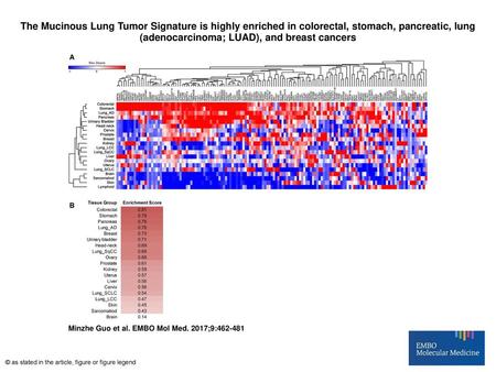 The Mucinous Lung Tumor Signature is highly enriched in colorectal, stomach, pancreatic, lung (adenocarcinoma; LUAD), and breast cancers The Mucinous Lung.