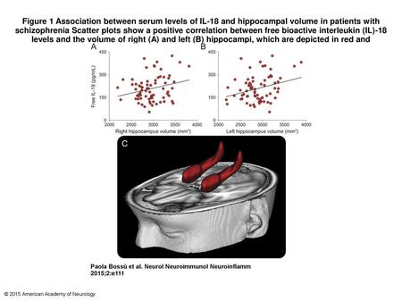 Figure 1 Association between serum levels of IL-18 and hippocampal volume in patients with schizophrenia Scatter plots show a positive correlation between.