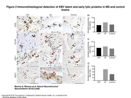 Figure 2 Immunohistological detection of EBV latent and early lytic proteins in MS and control brains Immunohistological detection of EBV latent and early.