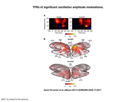 TFRs of significant oscillation amplitude modulations.