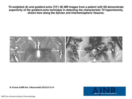 T2-weighted (A) and gradient-echo (T2