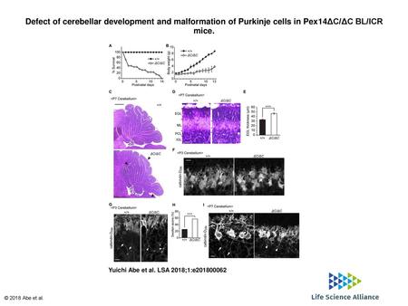 Defect of cerebellar development and malformation of Purkinje cells in Pex14ΔC/ΔC BL/ICR mice. Defect of cerebellar development and malformation of Purkinje.