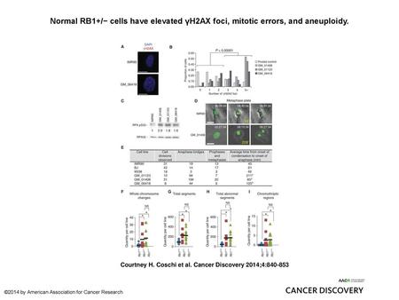 Normal RB1+/− cells have elevated γH2AX foci, mitotic errors, and aneuploidy. Normal RB1+/− cells have elevated γH2AX foci, mitotic errors, and aneuploidy.