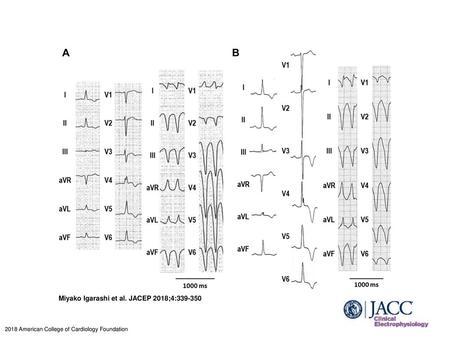 Miyako Igarashi et al. JACEP 2018;4: