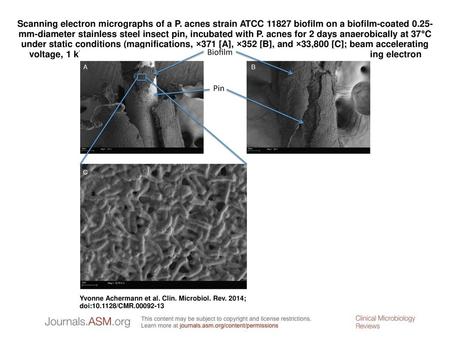 Scanning electron micrographs of a P