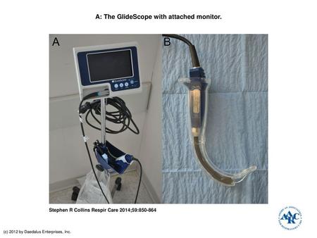 A: The GlideScope with attached monitor.