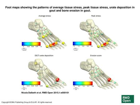 Foot maps showing the patterns of average tissue stress, peak tissue stress, urate deposition in gout and bone erosion in gout. Foot maps showing the patterns.