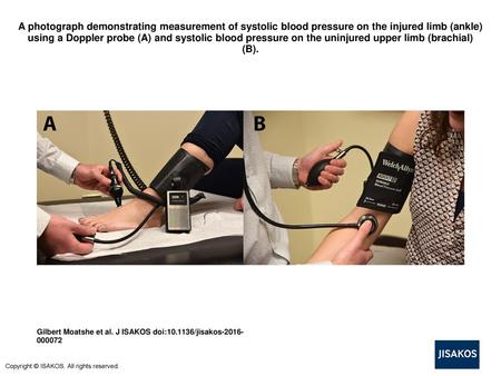 A photograph demonstrating measurement of systolic blood pressure on the injured limb (ankle) using a Doppler probe (A) and systolic blood pressure on.