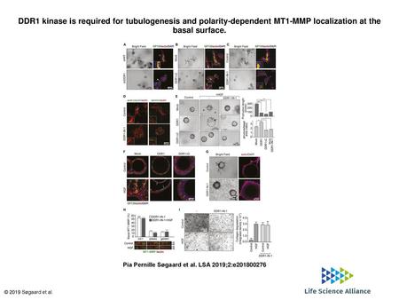 DDR1 kinase is required for tubulogenesis and polarity-dependent MT1-MMP localization at the basal surface. DDR1 kinase is required for tubulogenesis and.