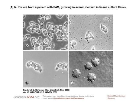 (A) N. fowleri, from a patient with PAM, growing in axenic medium in tissue culture flasks. (A) N. fowleri, from a patient with PAM, growing in axenic.