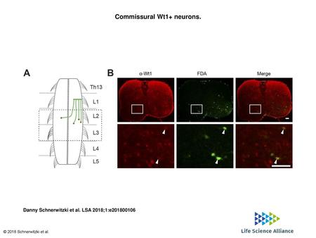 Commissural Wt1+ neurons.