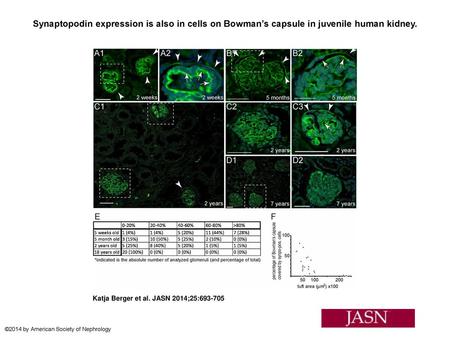 Synaptopodin expression is also in cells on Bowman’s capsule in juvenile human kidney. Synaptopodin expression is also in cells on Bowman’s capsule in.