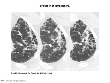 Evaluation of complications.