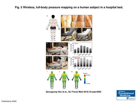 Fig. 5 Wireless, full-body pressure mapping on a human subject in a hospital bed. Wireless, full-body pressure mapping on a human subject in a hospital.