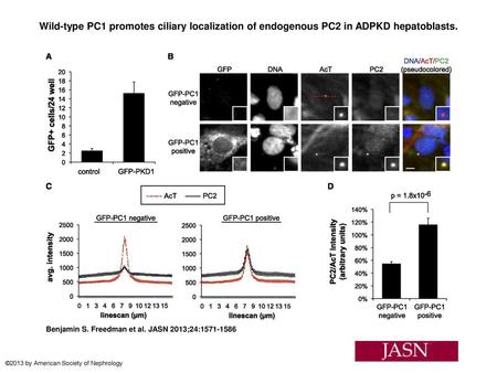 Wild-type PC1 promotes ciliary localization of endogenous PC2 in ADPKD hepatoblasts. Wild-type PC1 promotes ciliary localization of endogenous PC2 in ADPKD.