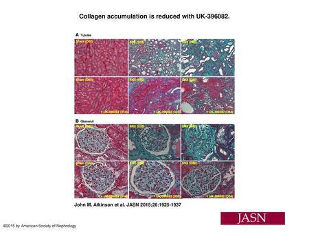 Collagen accumulation is reduced with UK