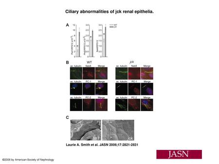 Ciliary abnormalities of jck renal epithelia.