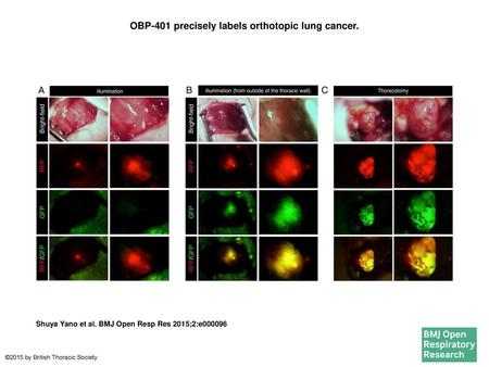 OBP-401 precisely labels orthotopic lung cancer.