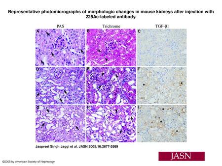 Representative photomicrographs of morphologic changes in mouse kidneys after injection with 225Ac-labeled antibody. Representative photomicrographs of.